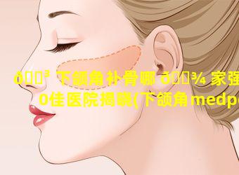 🐳 下颌角补骨哪 🌾 家强前50佳医院揭晓(下颌角medpor补骨)